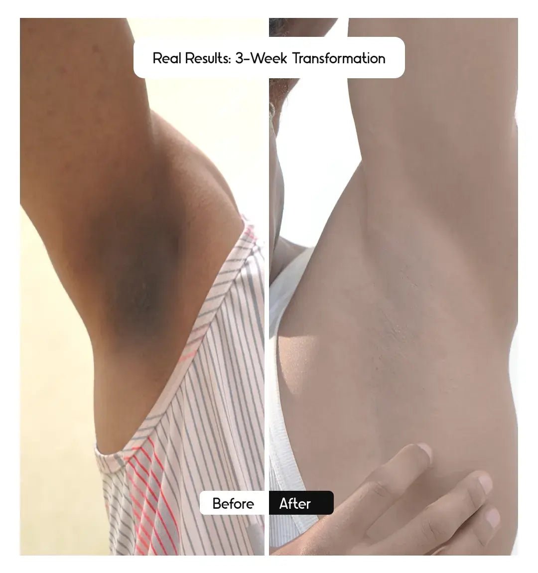 Brightening Underarm Roll - On Serum - Men - CosIQ