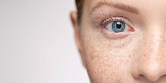 How to get rid of hyperpigmentation and uneven skin texture? - CosIQ