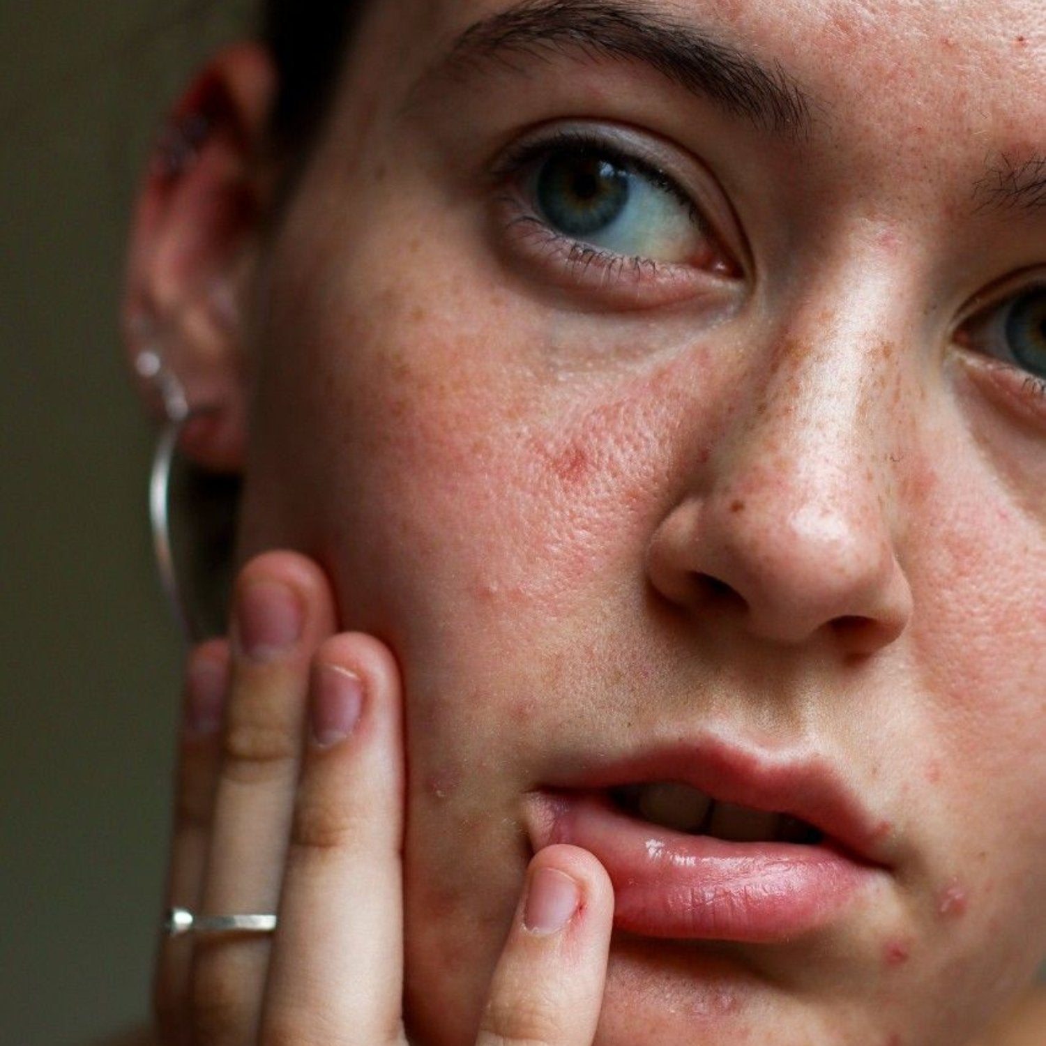 Repair your skin from the inside out - healing a damaged skin barrier ...