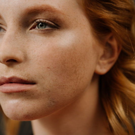Say goodbye to dark spots: the ultimate guide to hyperpigmentation! - CosIQ