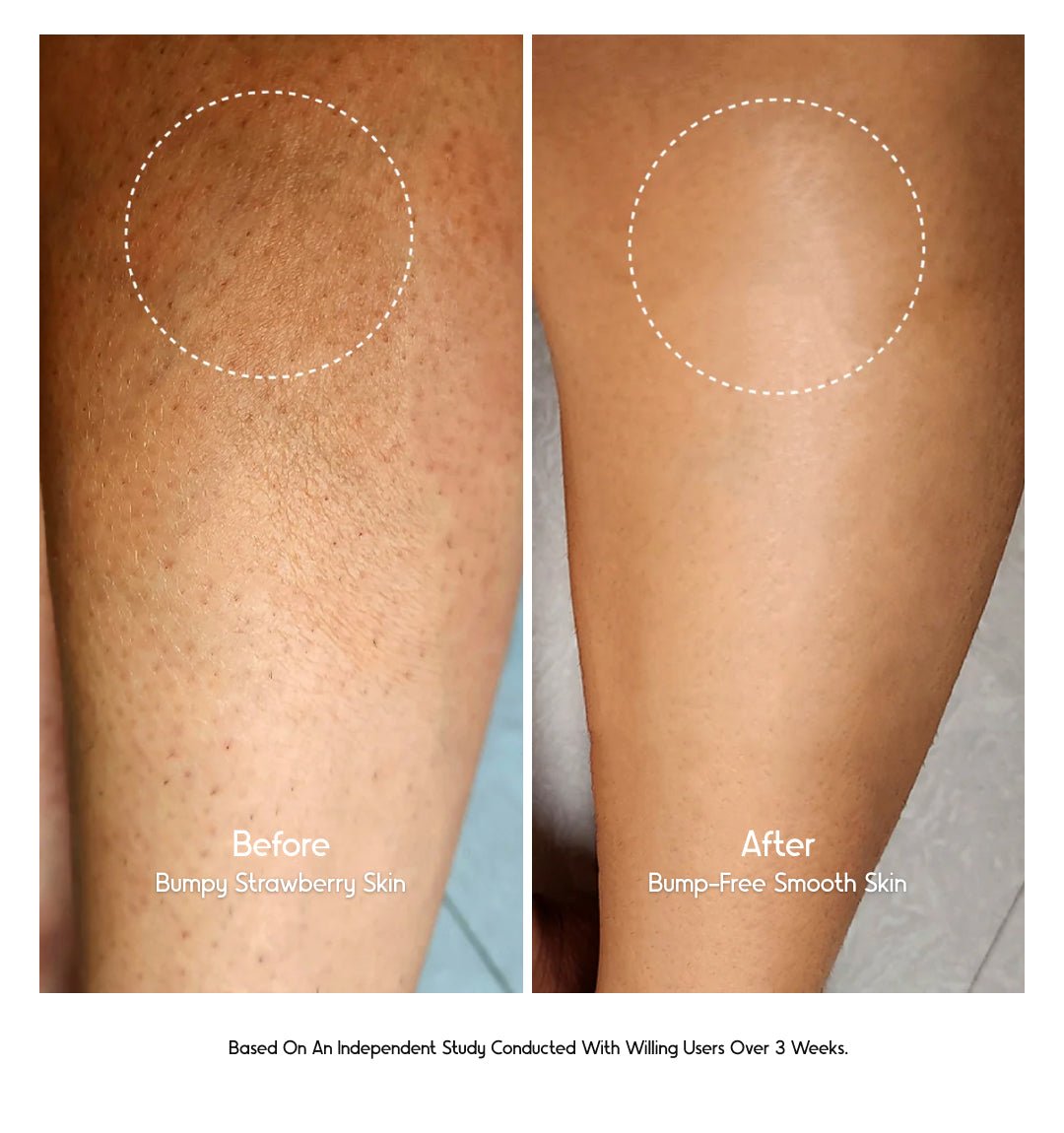 8% Glycolic Acid Toner Spray - CosIQ