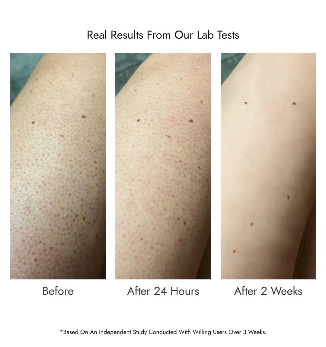 8% Glycolic Acid Toner Spray - CosIQ
