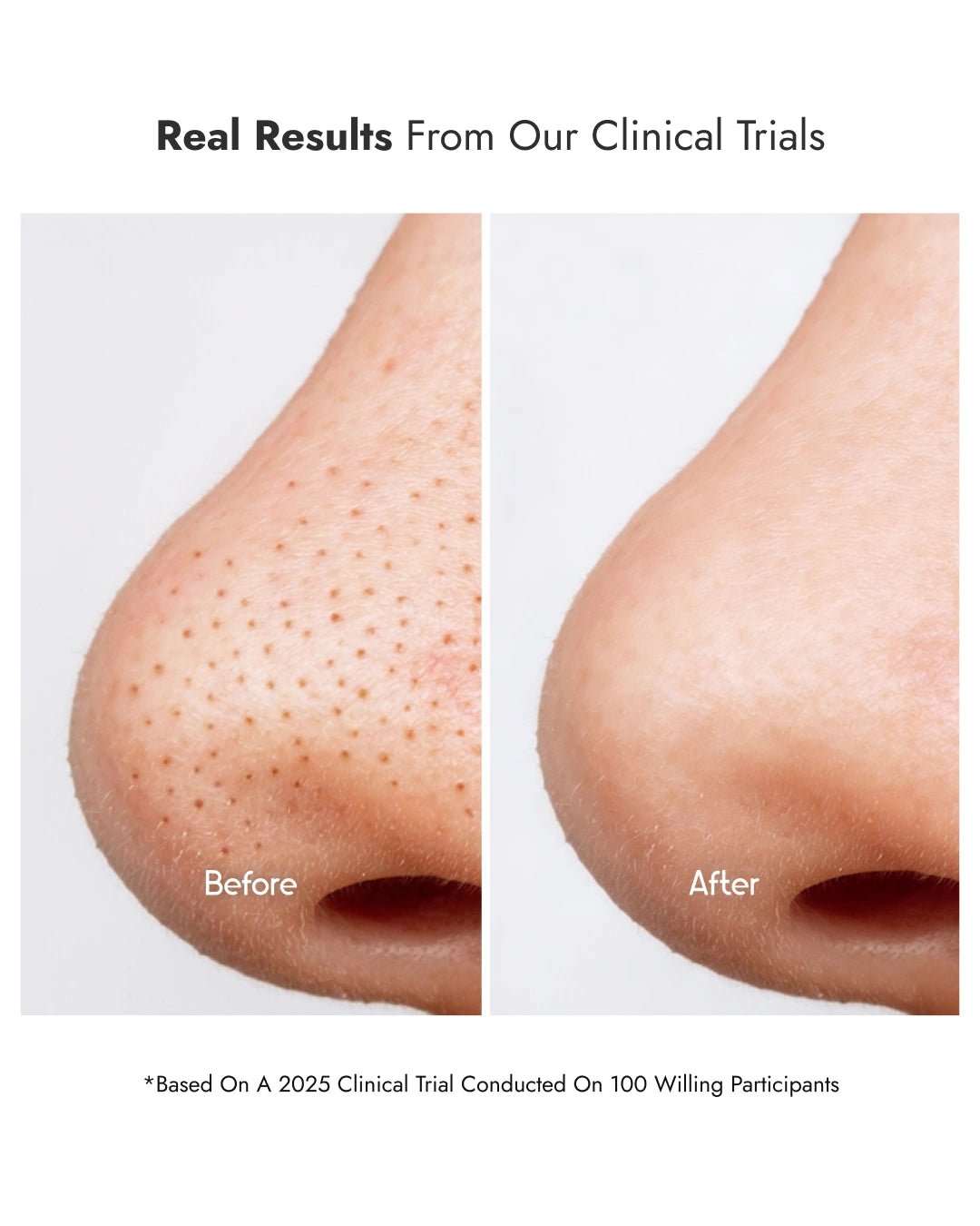 8% Glycolic Acid Toner Spray - CosIQ