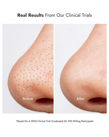 8% Glycolic Acid Toner Spray - CosIQ