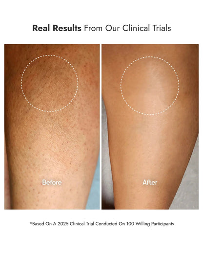 8% Glycolic Acid Toner Spray - CosIQ