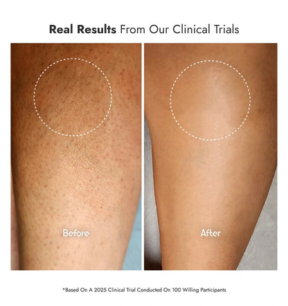 8% Glycolic Acid Toner Spray B1G1 - CosIQ