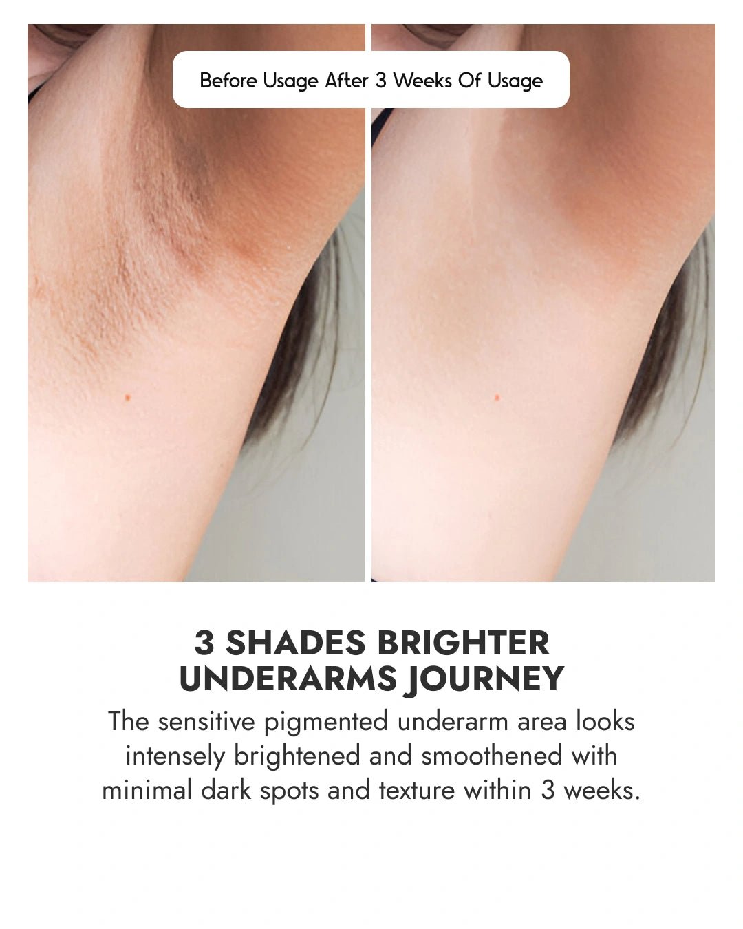 Brightening Underarm Roll - On Serum - Women - CosIQ