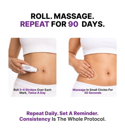 Stretch Mark Removal Roll-On Serum: 3-Month Clear Skin Kit (Pack Of 3 Bottles) - CosIQ
