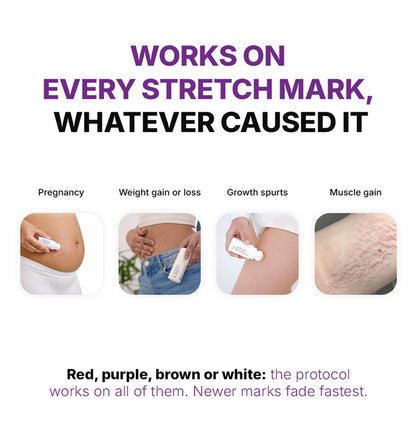Stretch Mark Removal Roll-On Serum: 3-Month Clear Skin Kit (Pack Of 3 Bottles) - CosIQ