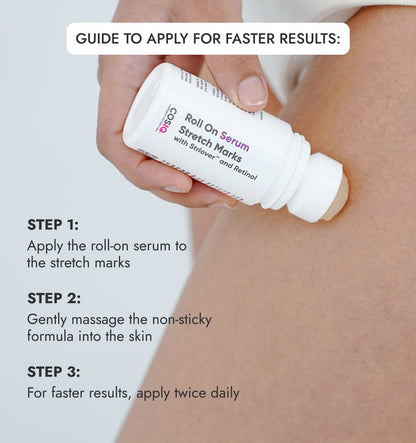 Stretch Mark Removal Roll - On Serum - CosIQ