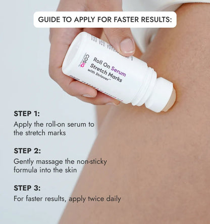 Stretch Mark Removal Roll - On Serum - CosIQ